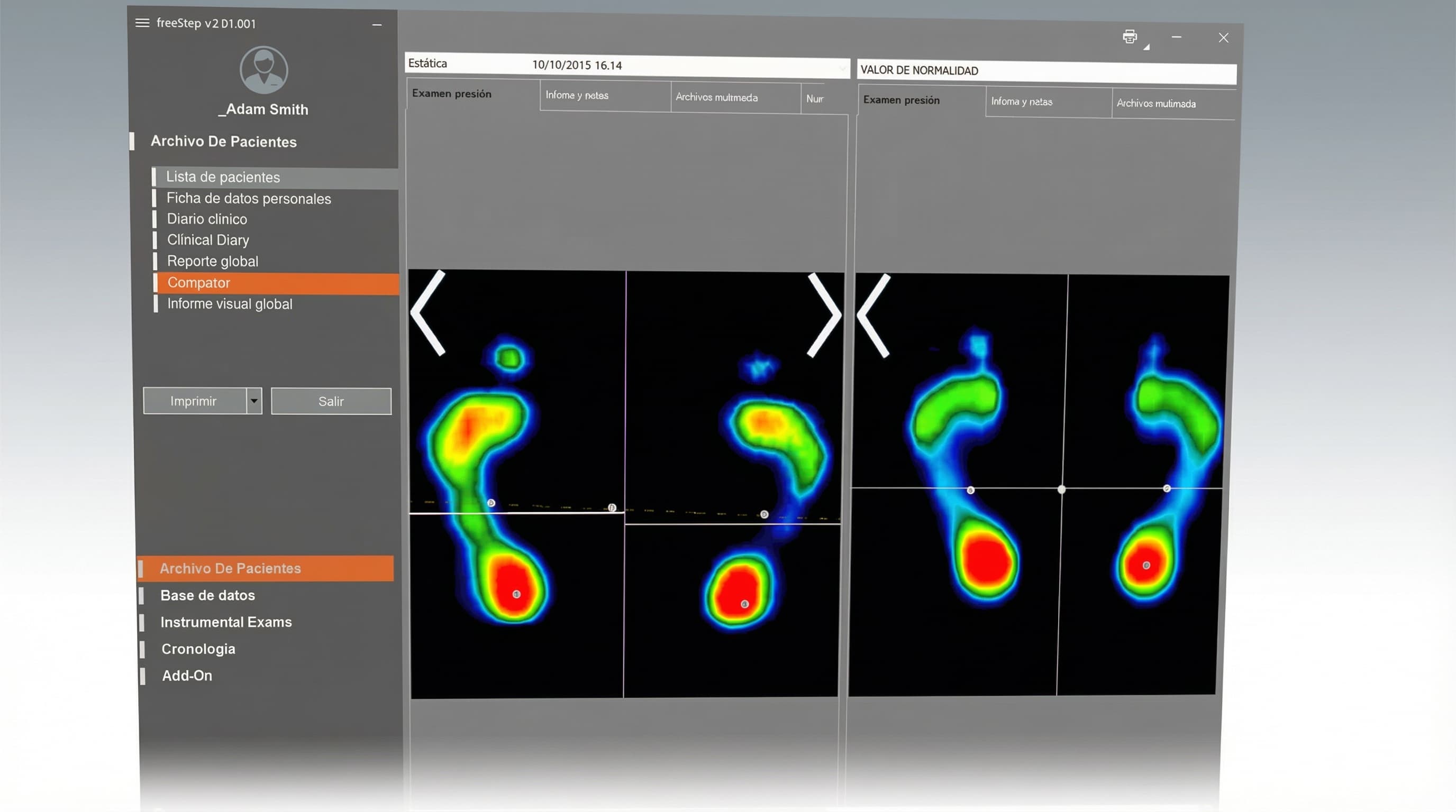 Análisis de presión plantar baropodometría