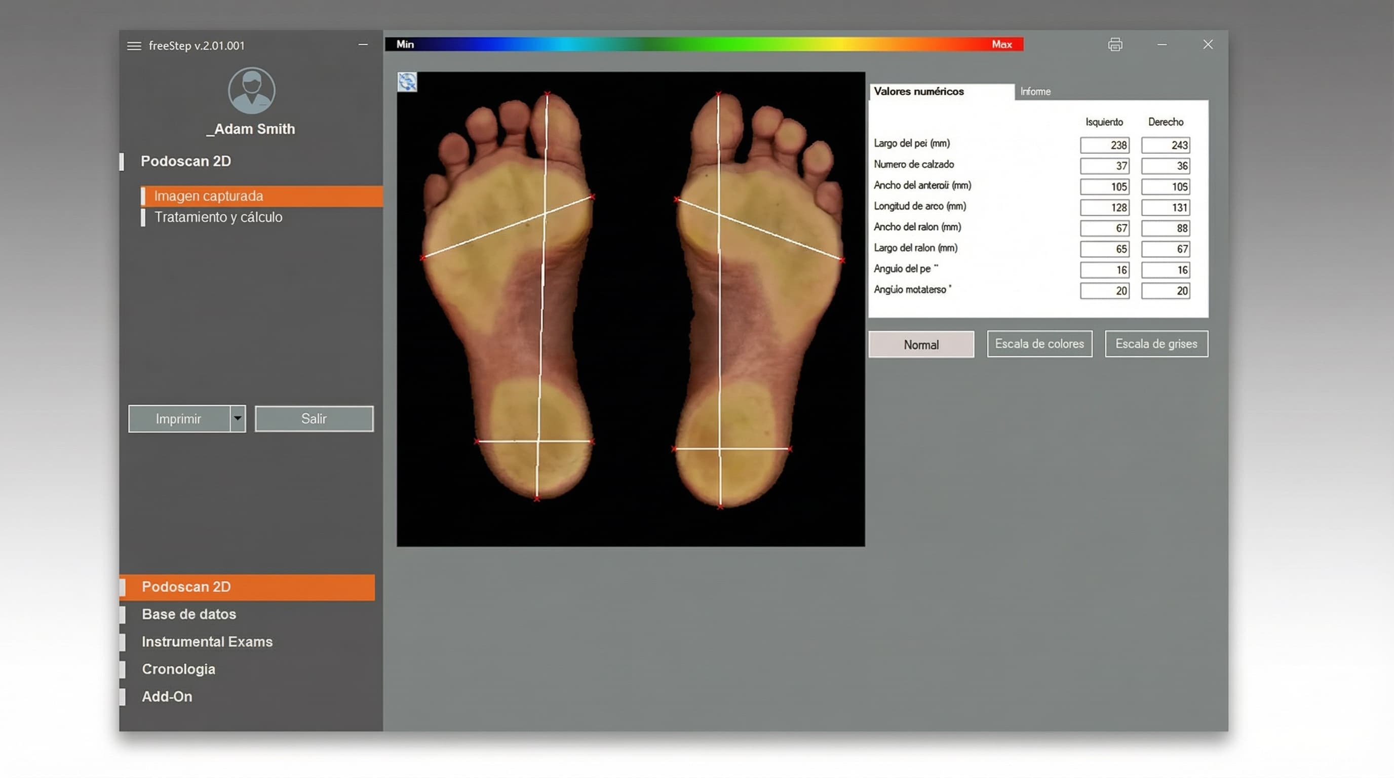 Escaneo de pie con medidas precisas Podoscan
